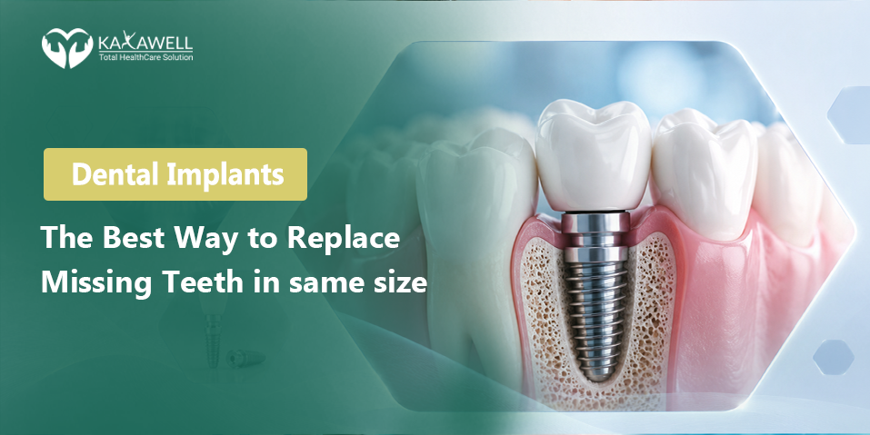 Dental Implants: The Best Way to Replace Missing Teeth