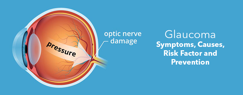 Glaucoma- Symptoms, Causes, Risk Factor and Prevention