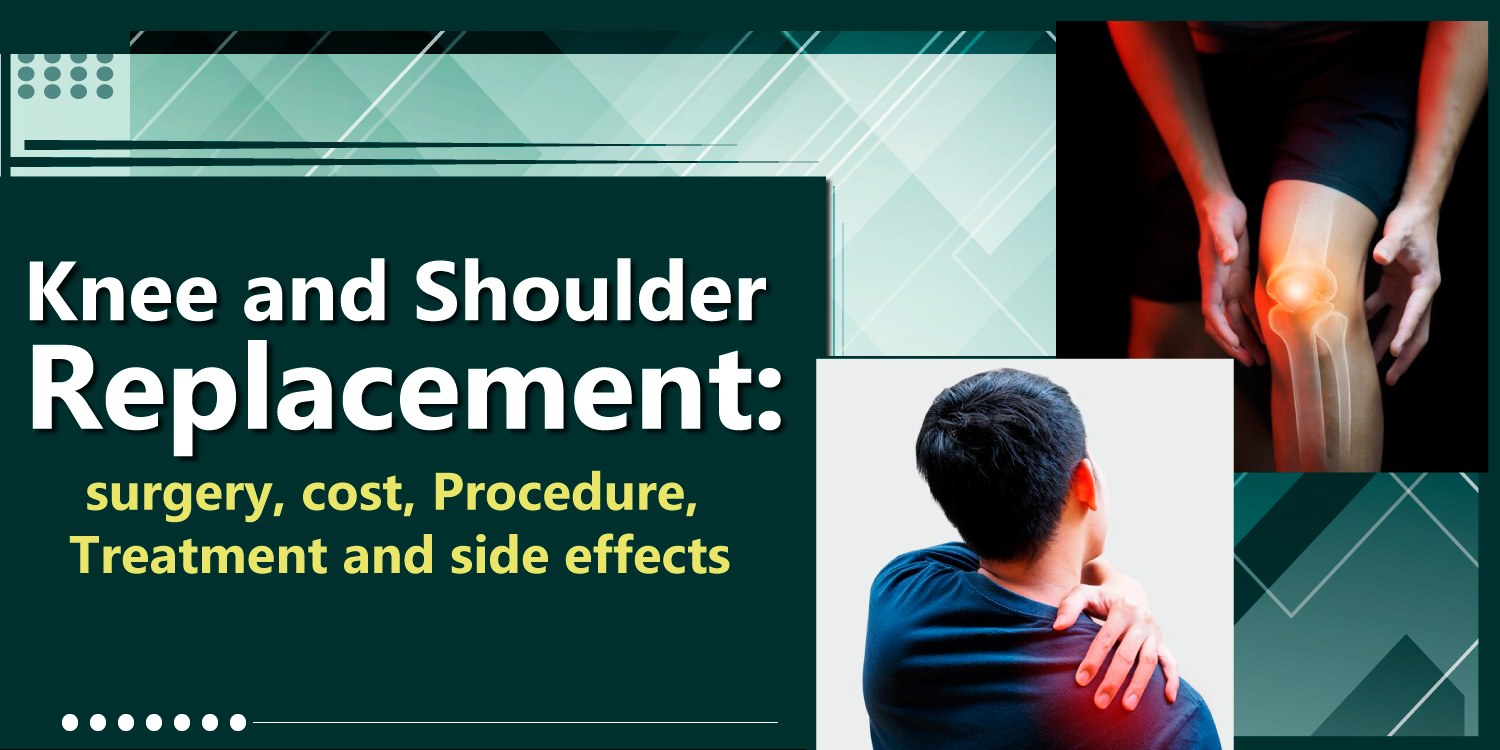 knee and shoulder replacement