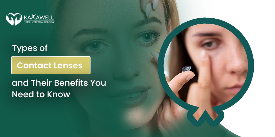Contact Lenses