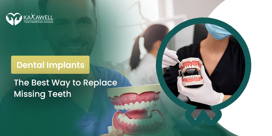 Dental Implants The Best Way to Replace Missing Teeth