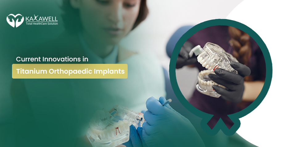 Titanium Orthopaedic Implants