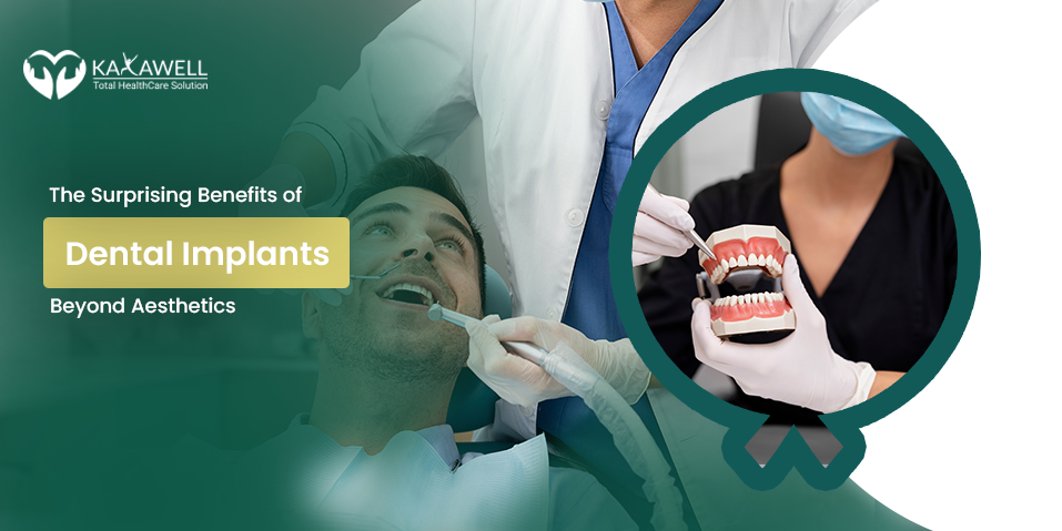 Dental Implants