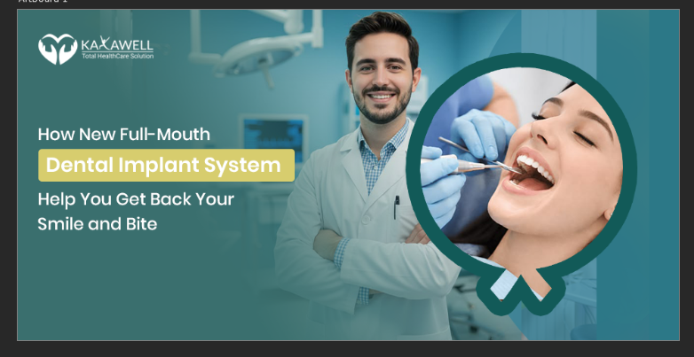 How New Full-Mouth Dental Implant Systems Help You Get Back Your Smile and Bite