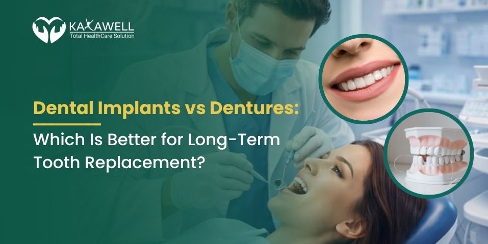 Dental Implants vs Dentures